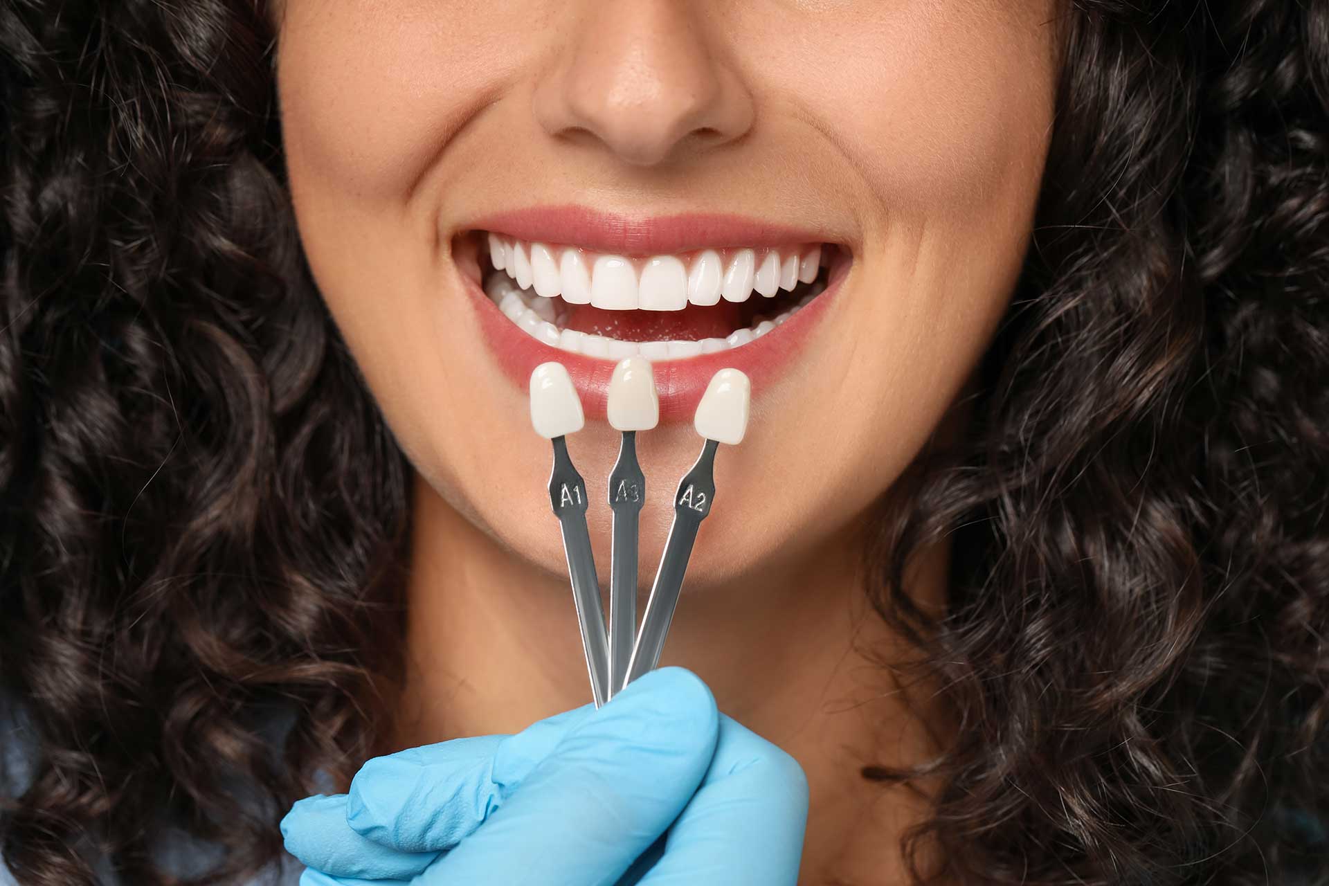 A Comprehensive Look at the Dental Veneers Procedure